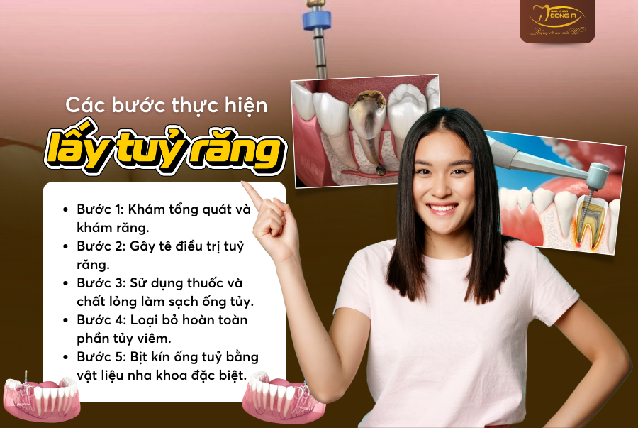 lay-tuy-boc-rang-su