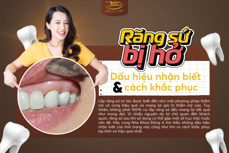 rang-su-bi-ho