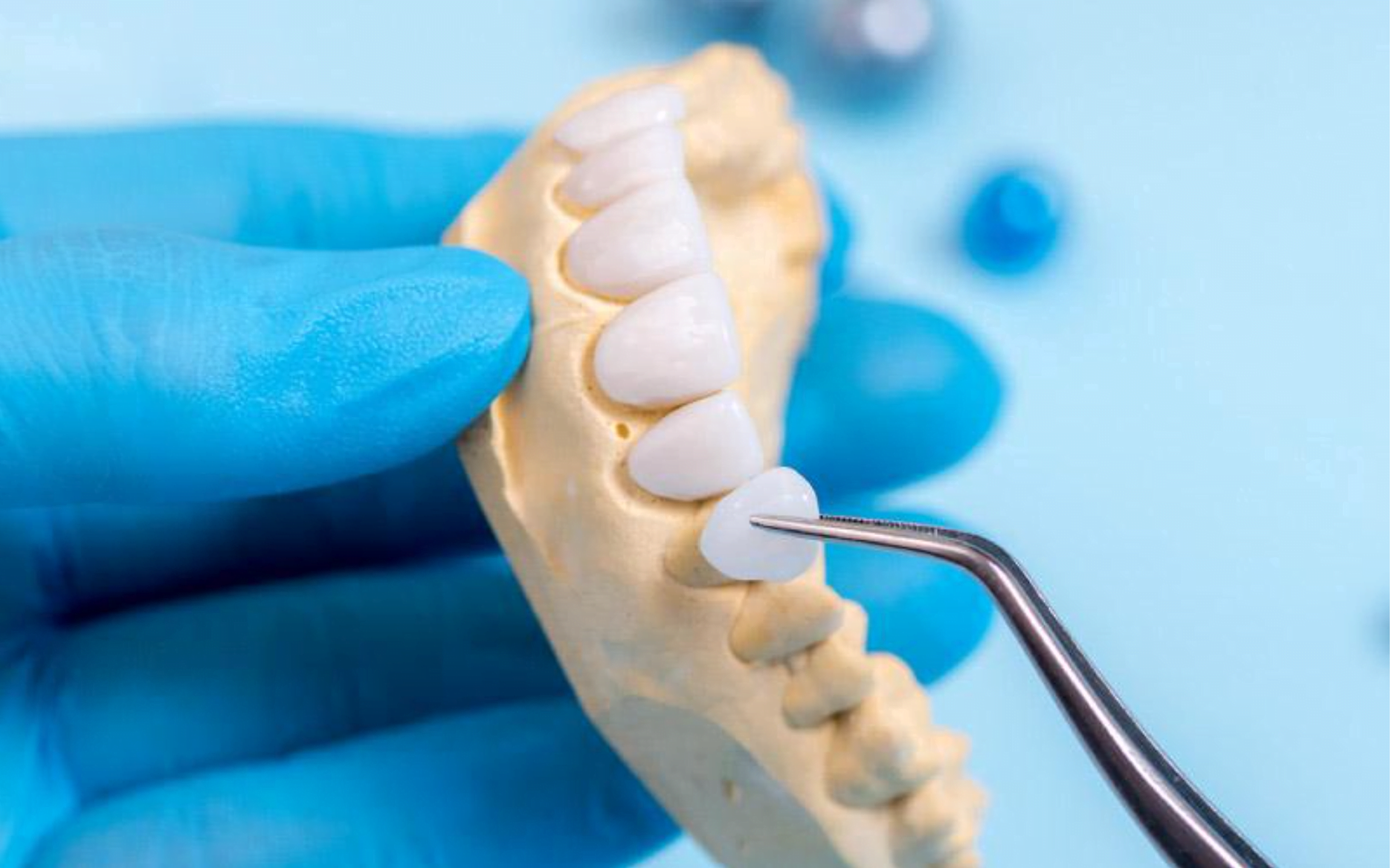 Răng sứ Zirconia được chế tác tỉ mỉ