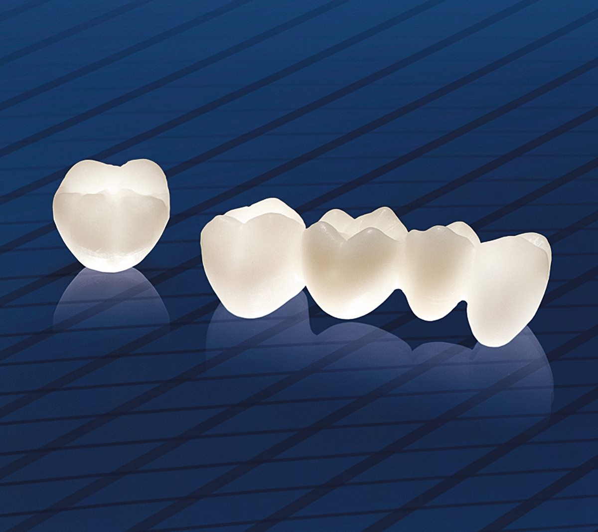 Răng sứ Cercon Zirconia