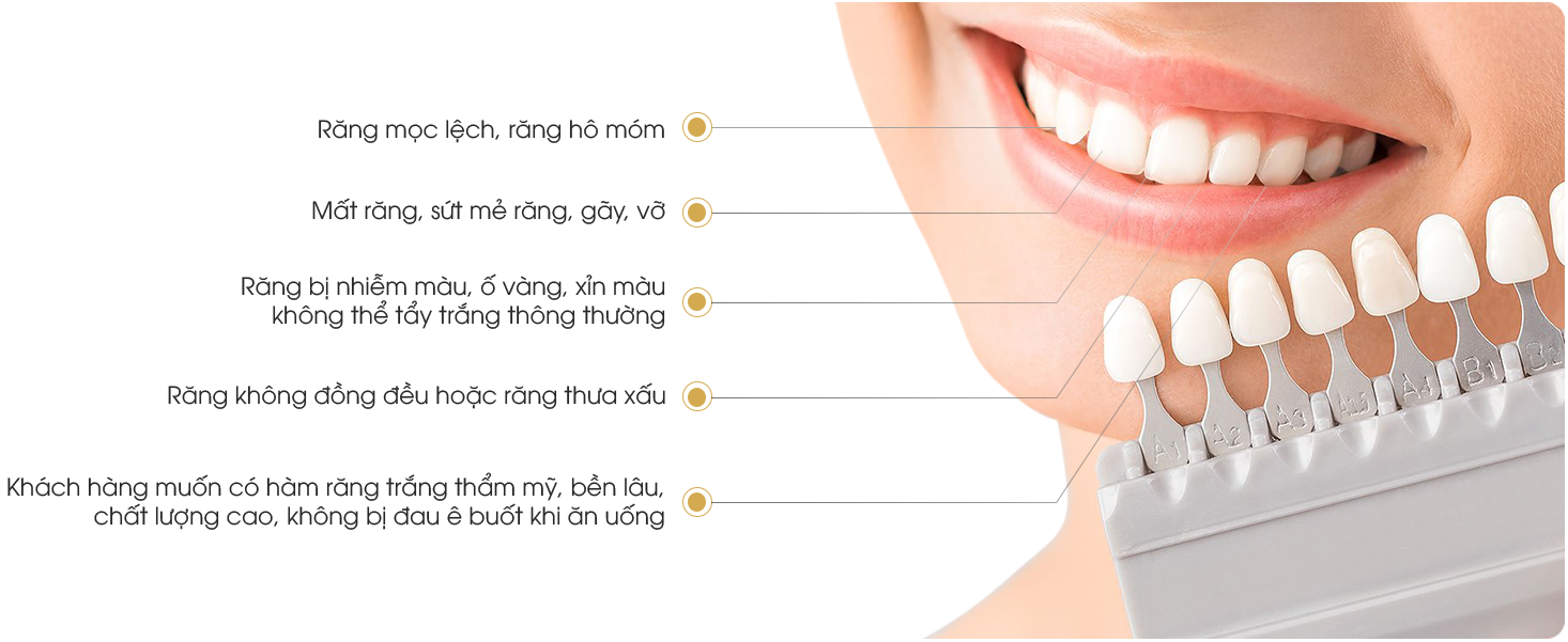 Răng sứ Venus khắc phục nhược điểm của răng