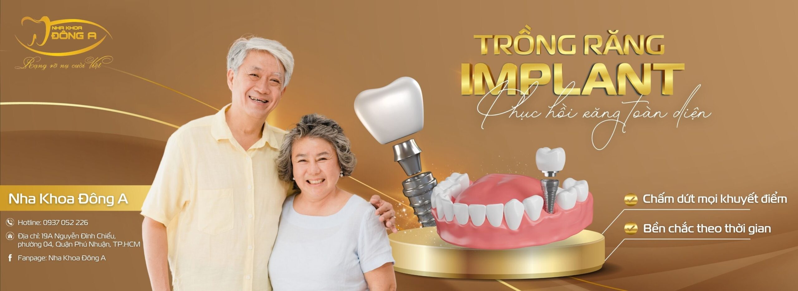 Giá trồng răng implant tại Nha khoa Đông A