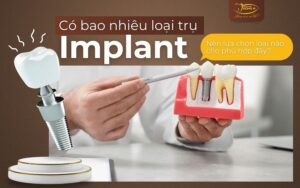 Tru-Implant-pho-bien-hien-nay