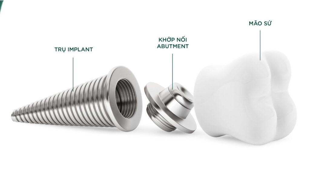 Healing implant là gì?