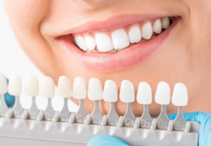 Sứ HT Smile chịu lực gấp 5 lần so răng thật