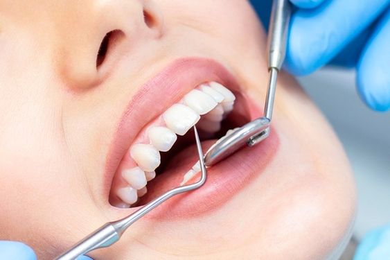 Điều trị tại nha khoa
