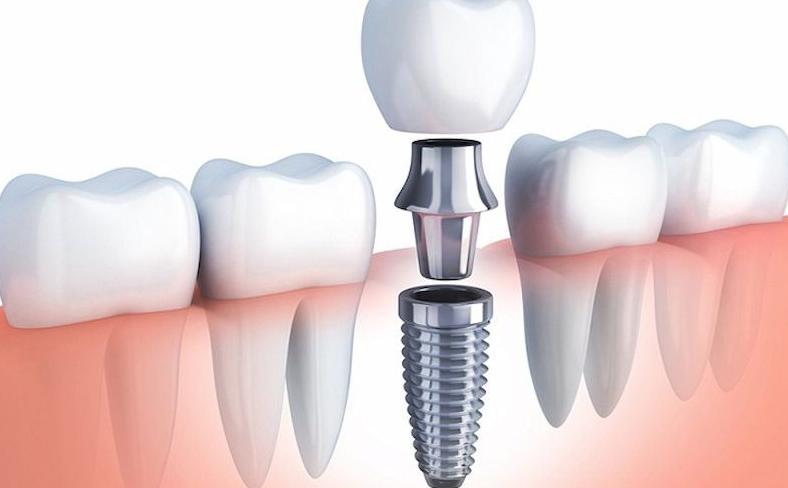 Thiết kế tối ưu, rút ngắn thời gian lành thương