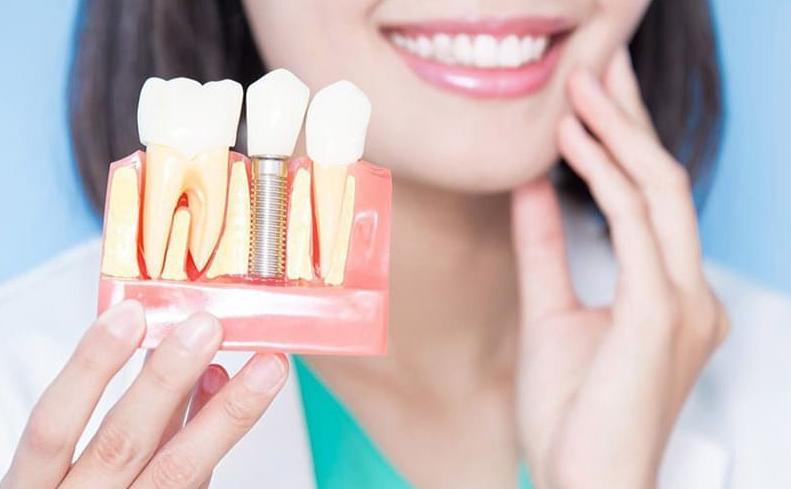 Cấy ghép Implant Hiossen ngay khi mất răng