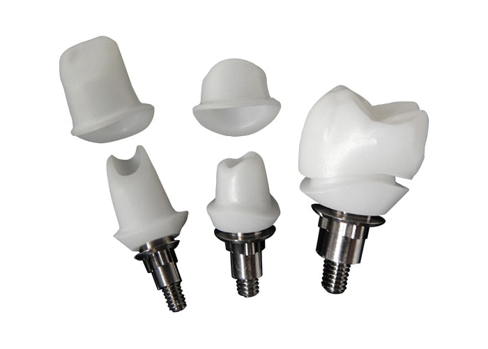 Chất liệu abutment phổ biến