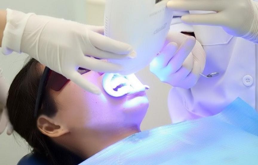 Tẩy trắng răng tại phòng khám