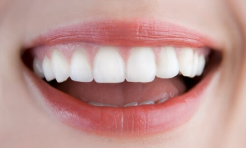 có nên súc nước muối sau khi bọc răng sứ 