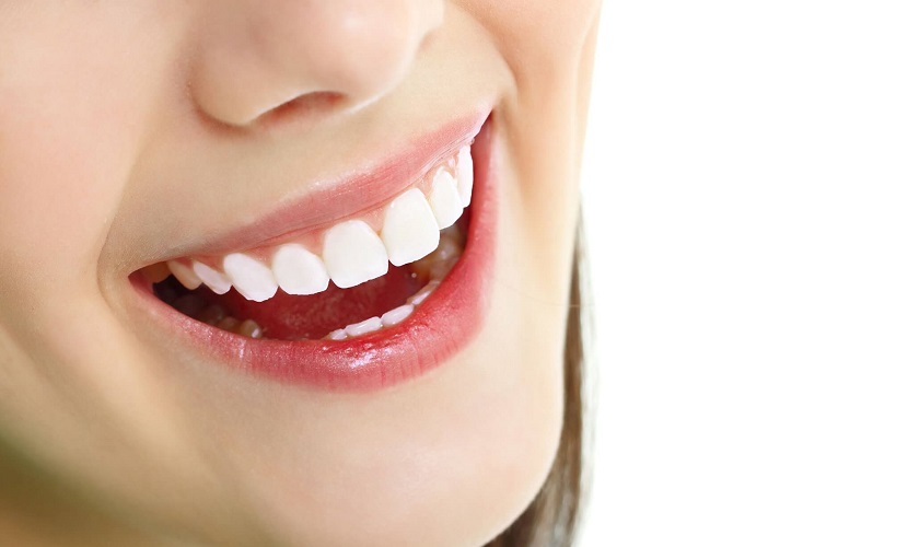 Chi phí sửa răng sứ bị mẻ