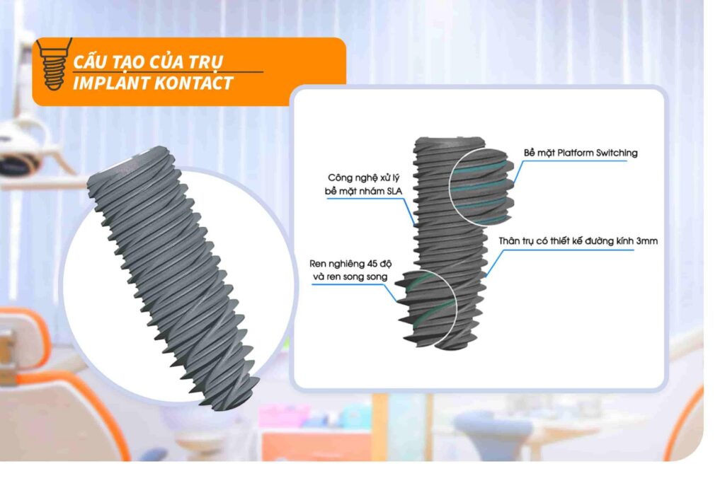 Cấu tạo Trụ Implant Kontact
