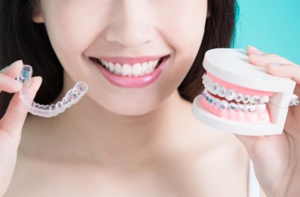 Niềng răng trả góp như thế nào