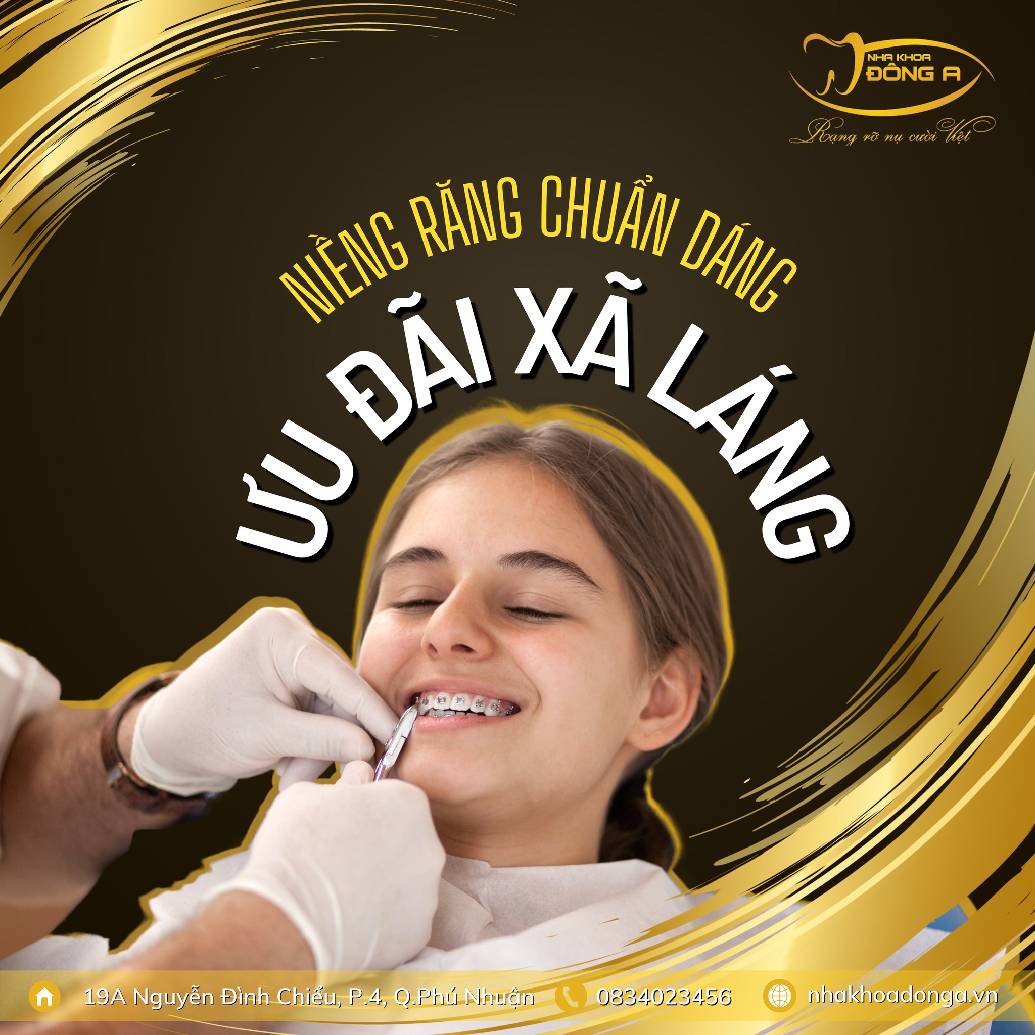 Niềng răng trả góp được không