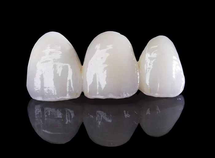Răng sứ Zolid là gì 