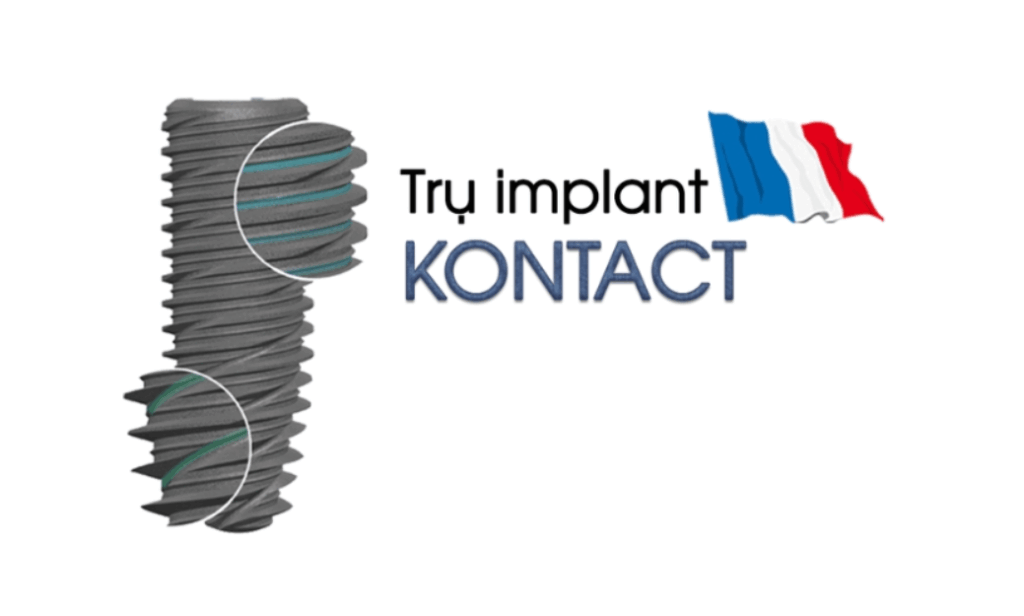 Trụ Implant Kontact Pháp