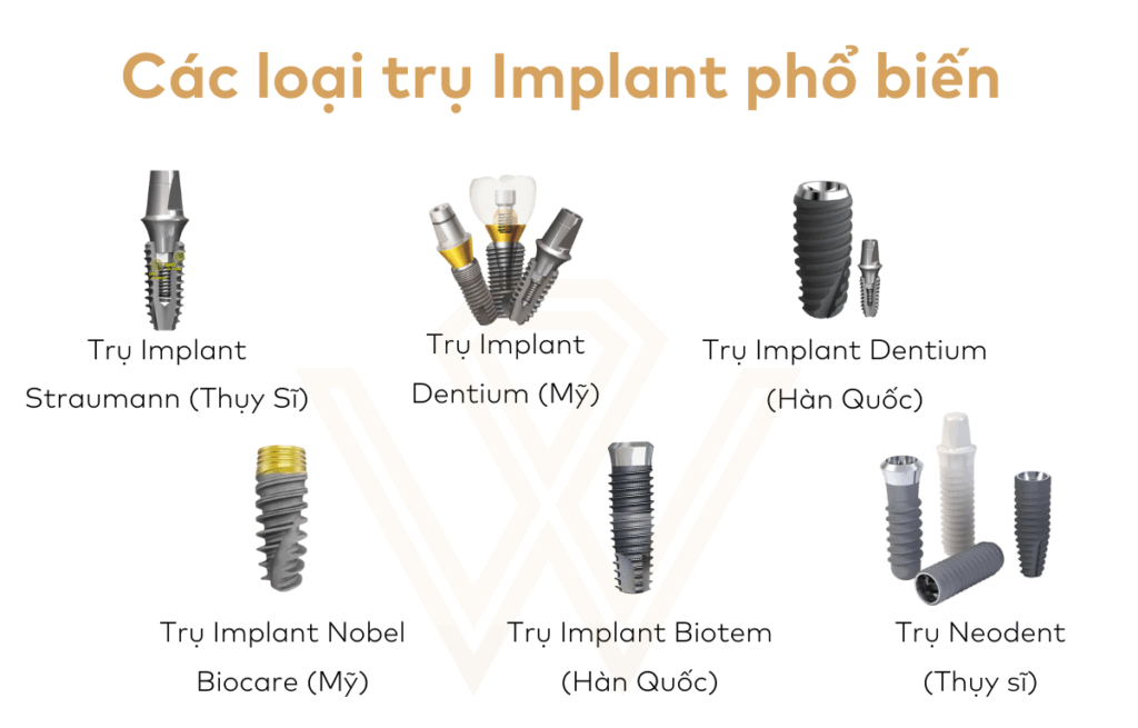 Ưu điểm nổi bật của các loại trụ implant