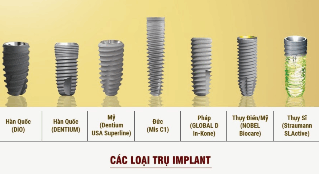 Các loại trụ implant phổ biến hiện nay 