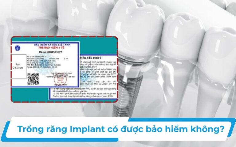 Trồng răng implant có được bảo hiểm không