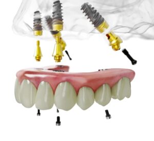 trụ implant Nobel